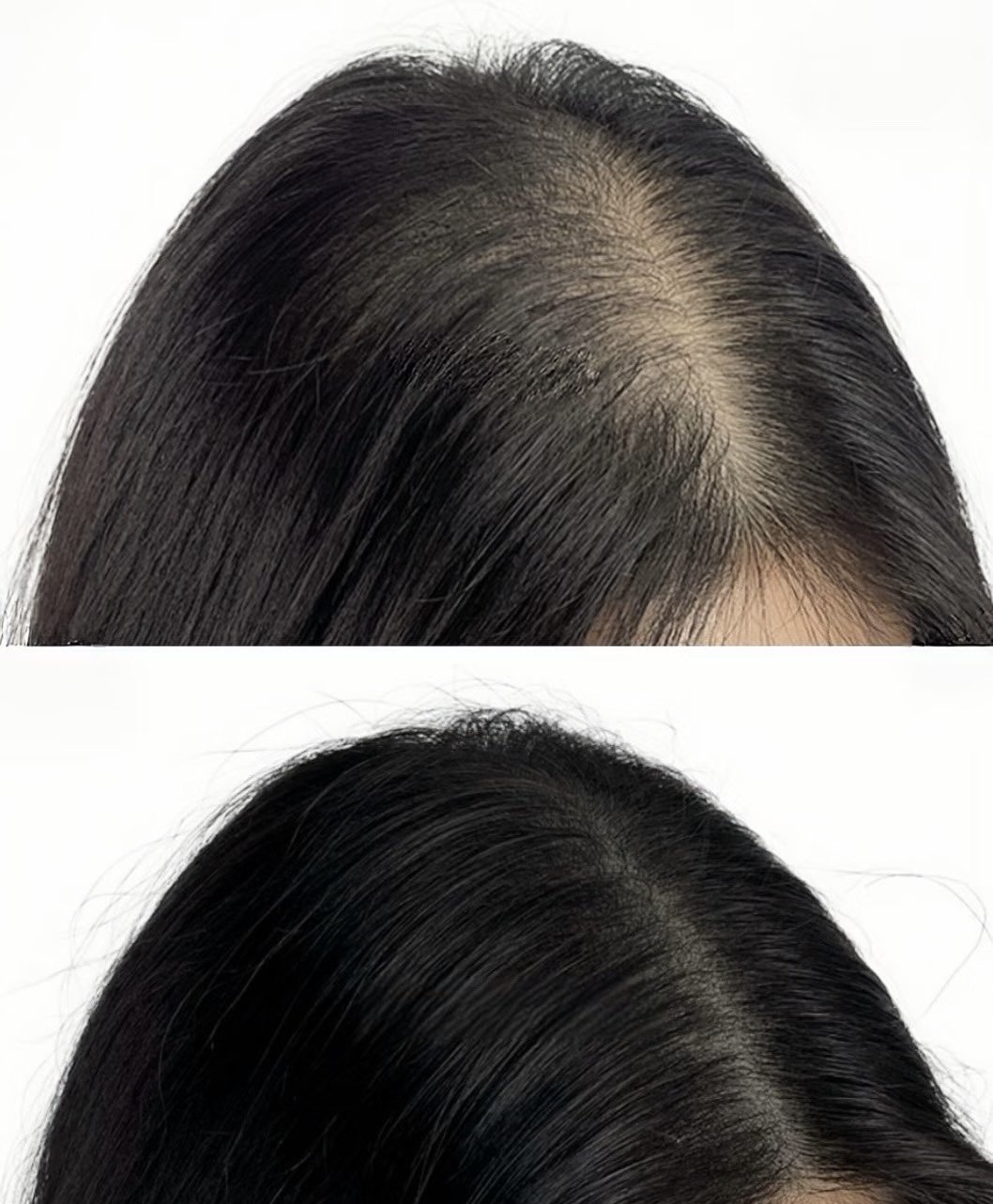 Hair density tattoo before and after for a wider hair part and thinning hair