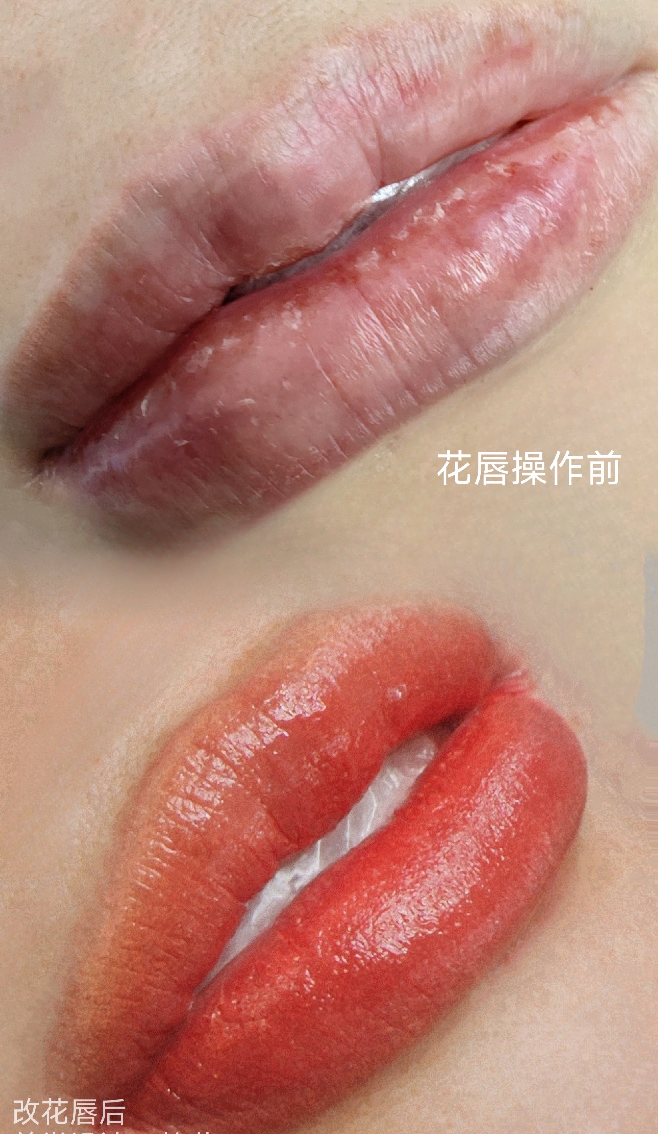 Lip tattoo before and after for uneven lip color correction 
