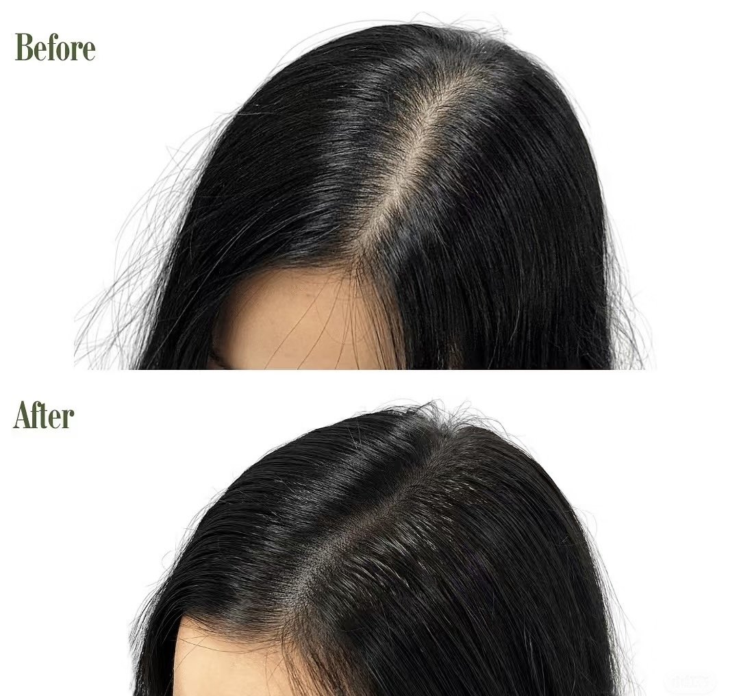 Hair tattoo for thinning hair creating a fuller-looking hair part