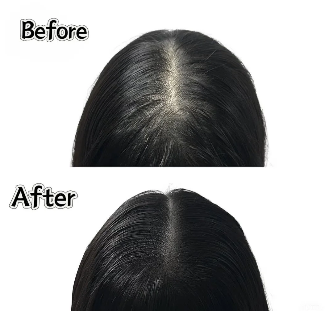 Scalp Micropigmentation before and after for natural looking hair density