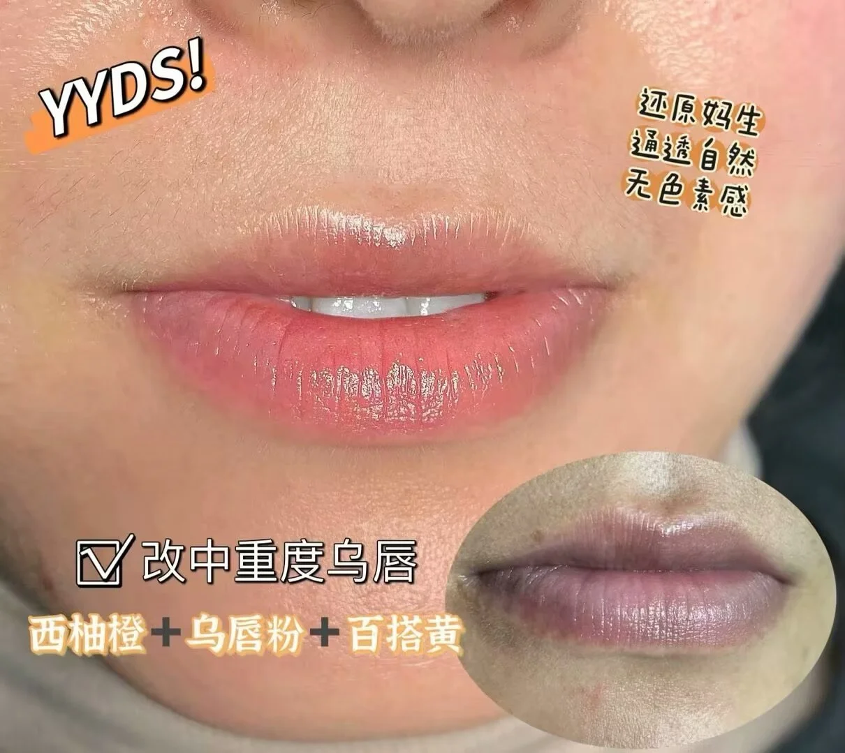 Natural lip blush tattooing creating soft pink lips and healthy looking permanent lip color