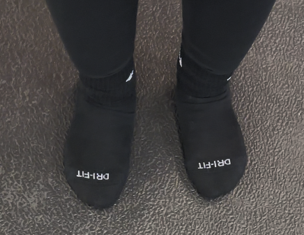 Flat footed person with flat feet before the usage of program