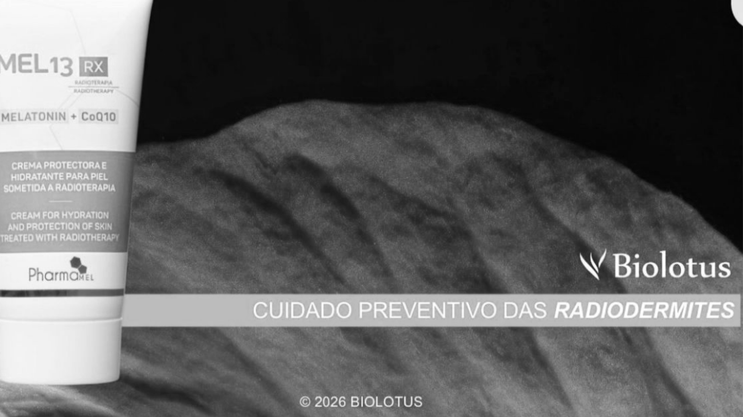 #Project -  “Skin and Radiotherapy” MEL13 RX