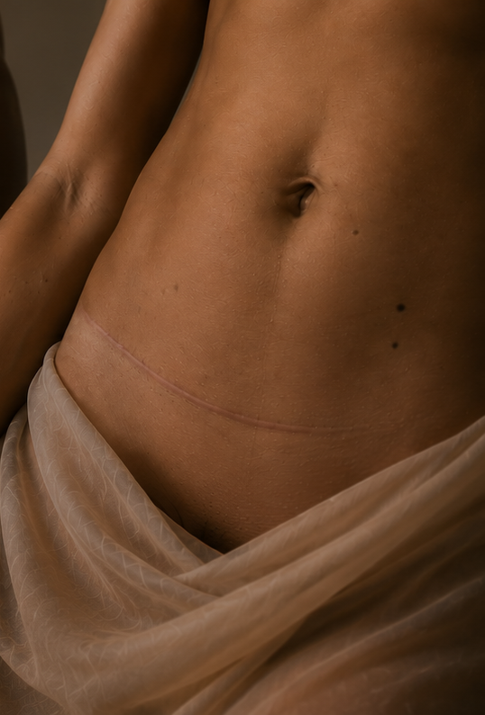 Close-up of natural lower abdominal skin with a healed scar, highlighting real skin texture and body confidence.