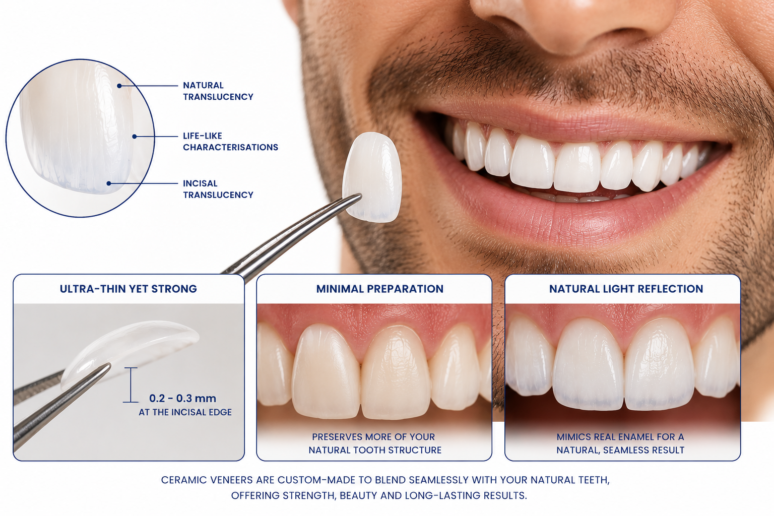 Close-up of a smiling man showing white teeth, holding a dental veneer with tweezers. The image includes detailed text explaining the translucency, strength, and natural appearance of ceramic veneers, with labels highlighting veneer features like natural translucency and light reflection, alongside diagrammatic explanations of veneer thickness, preparation, and appearance.