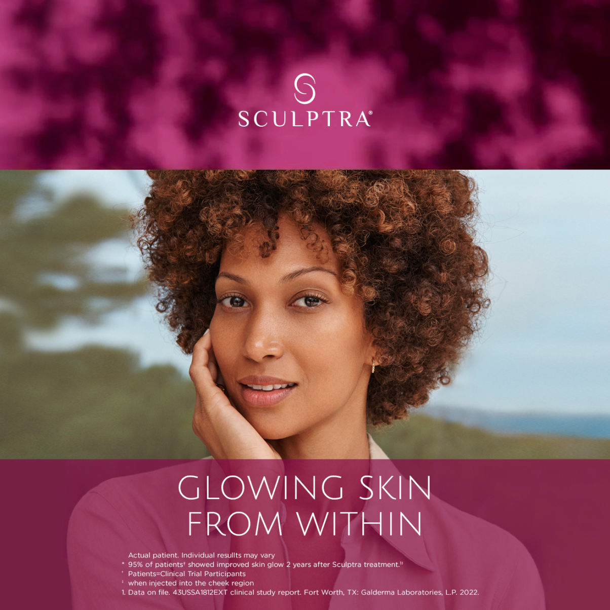 A woman with curly brown hair posing outdoors with a blurred nature background, promoting Sculptra treatment for glowing skin from within.