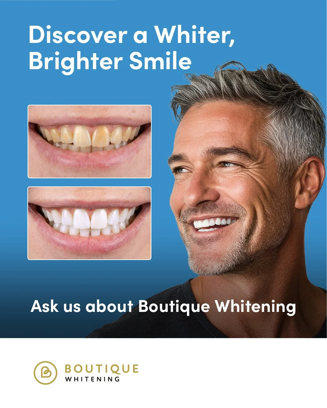 Advertisement for Boutique Whitening, showcasing before and after images of teeth whitening, with a smiling man and a blue background.