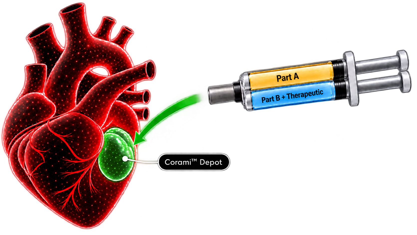 Corami localized therapeutic delivery system applying treatment to the heart