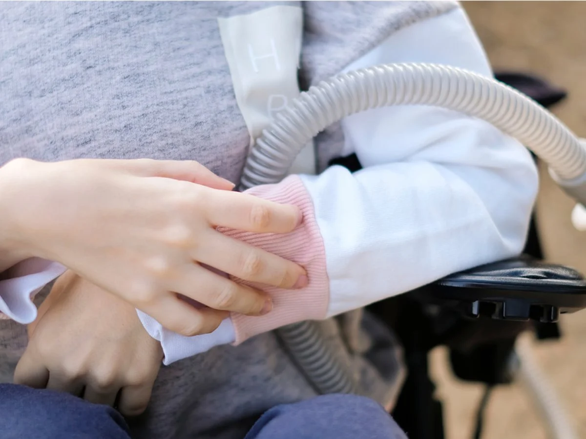 What is Becker Muscular Dystrophy?