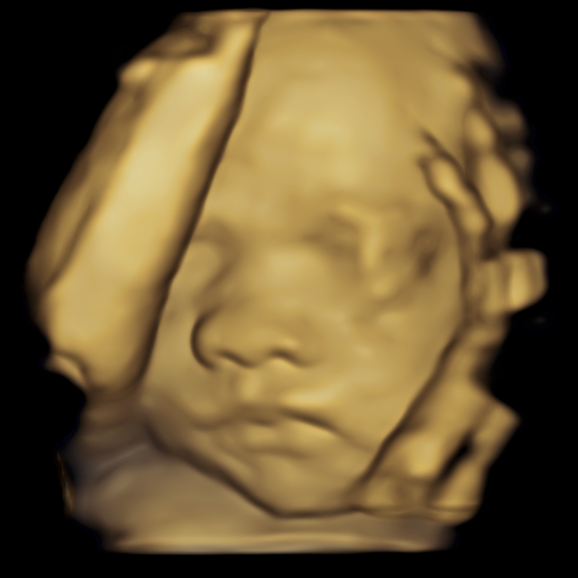 3D gold-colored sculpture of a human face with closed eyes, one hand resting on the forehead.