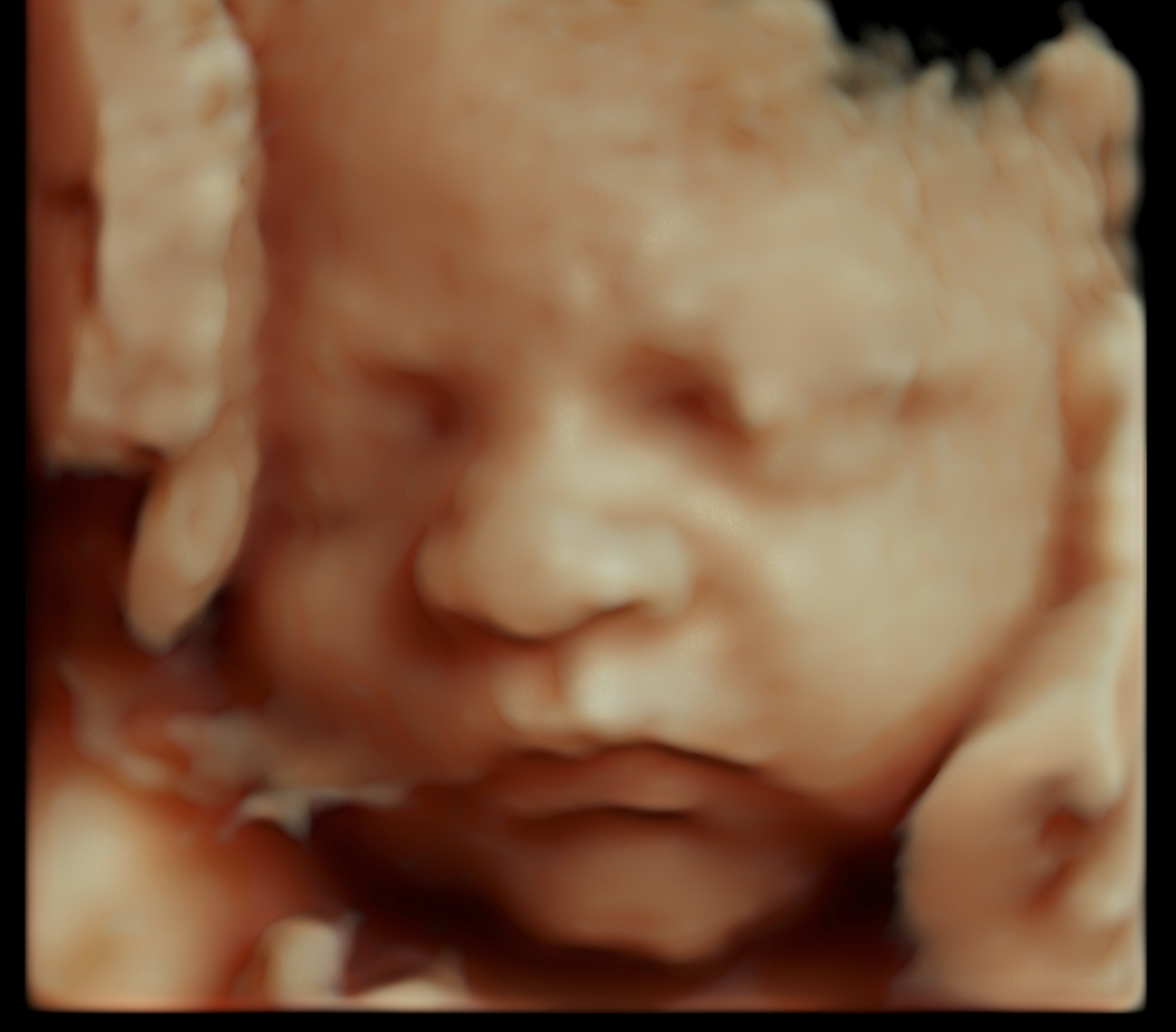 Close-up of a newborn baby's face sleeping peacefully.