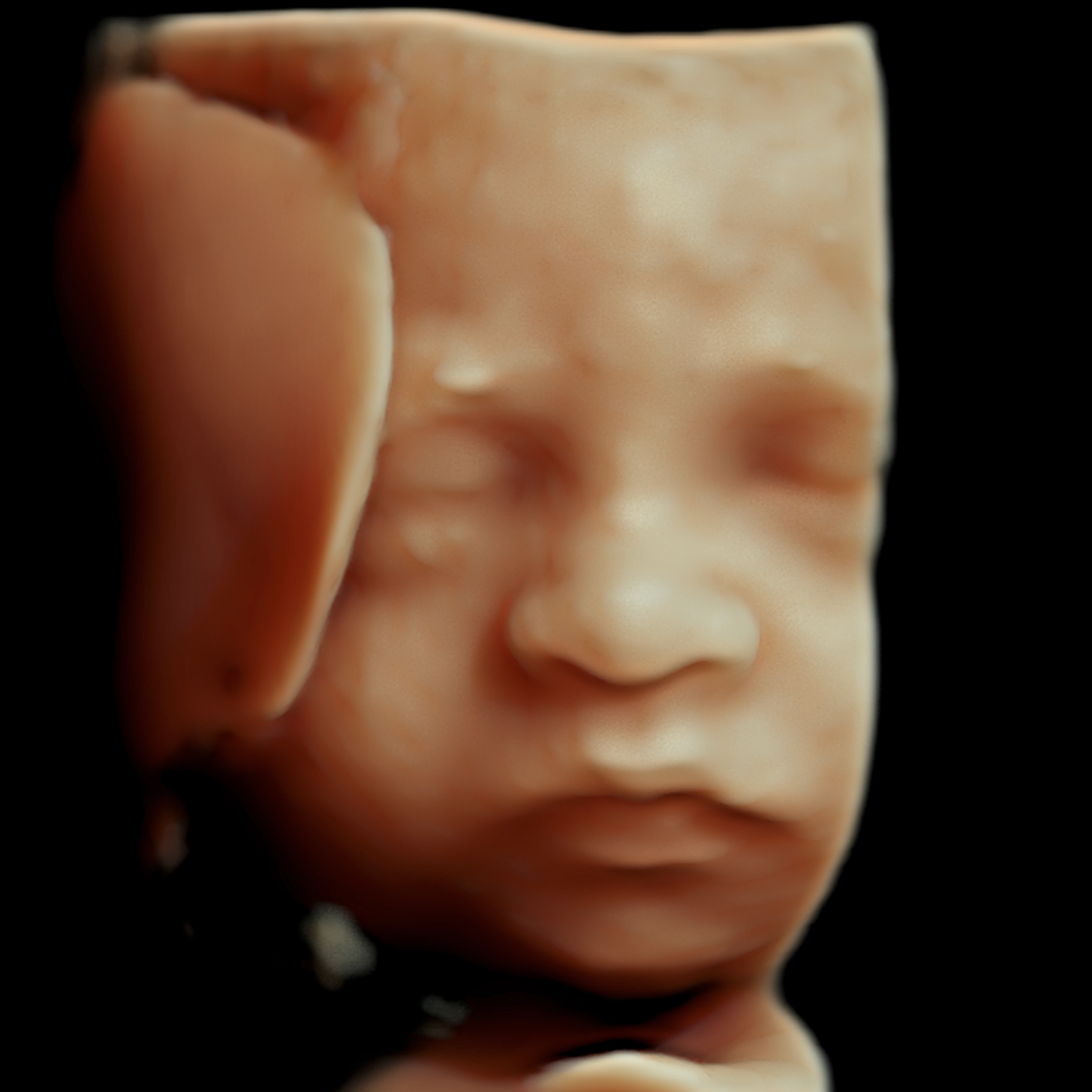 Close-up of a child's face with eyes closed and head resting on hand, against a black background.