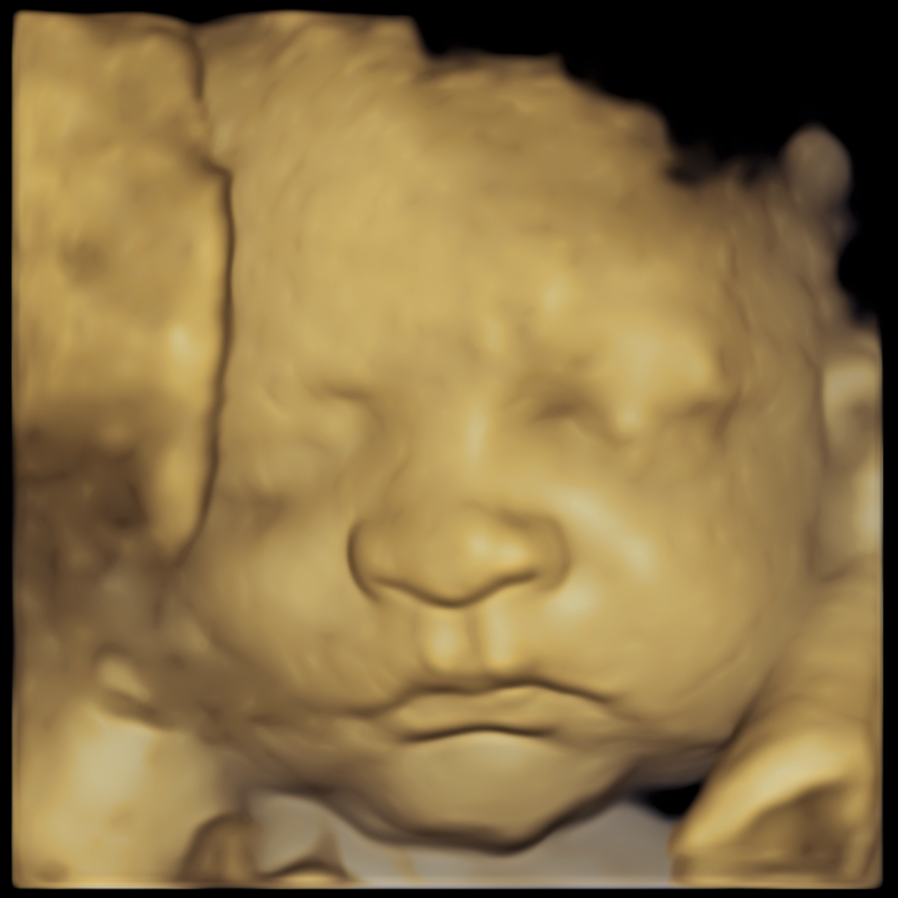 A 3D ultrasound image of a sleeping baby’s face with detailed features.