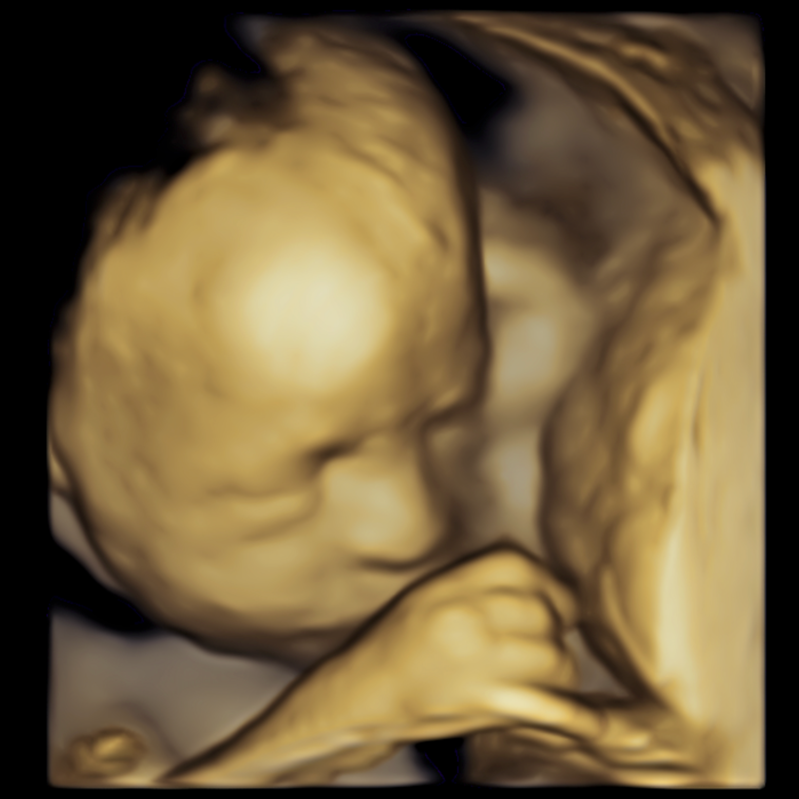Close-up of a beige and brown patterned marble sculpture of a baby's face.