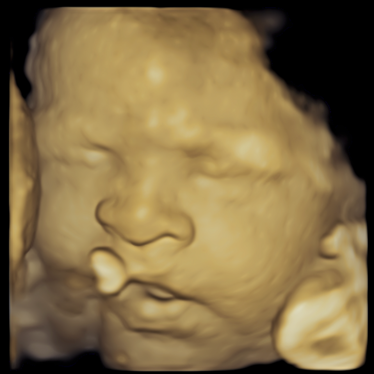 3D ultrasound image of a sleeping baby