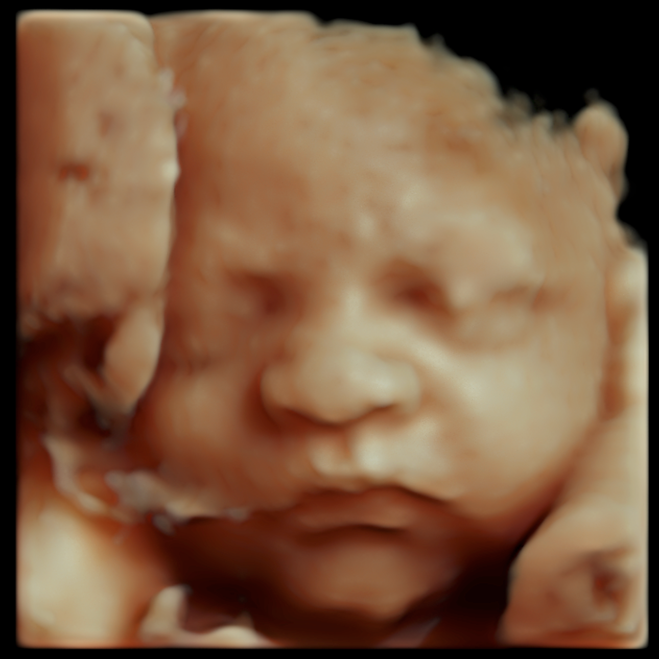 Close-up of a human fetus in the womb, showing facial features and hands.
