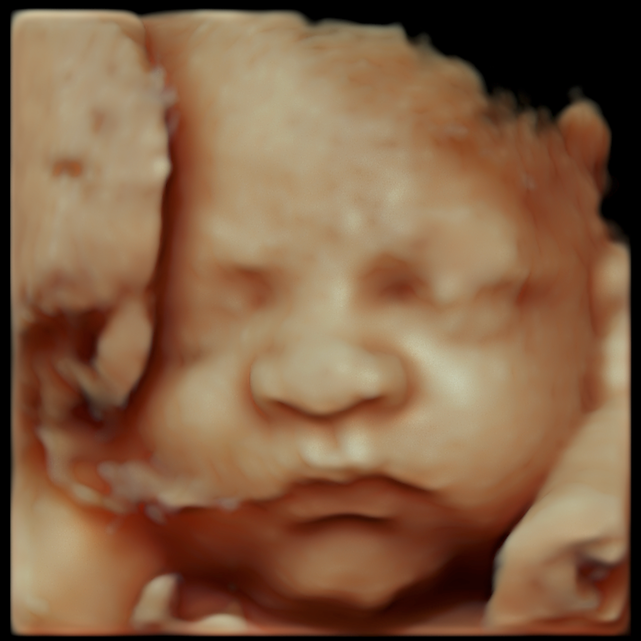 Close-up of a baby fetus's face with the eye closed, showing detailed skin texture.