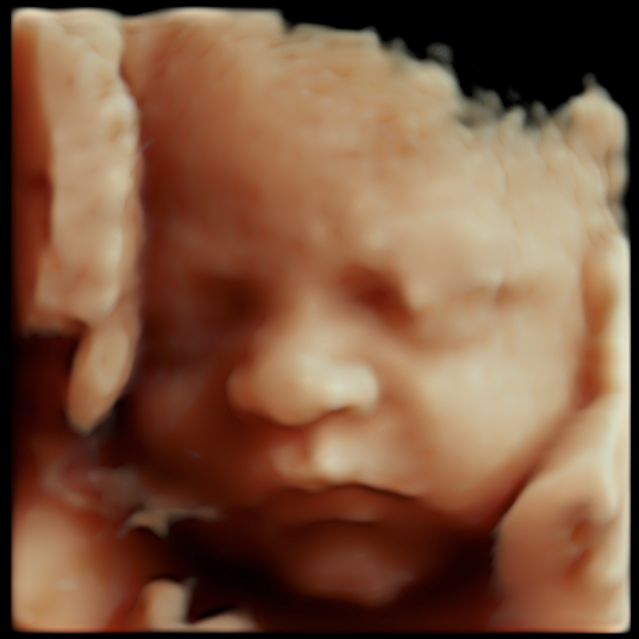 Close-up of a baby’s face with soft skin, lying down with eyes closed, partially covered by a blanket.