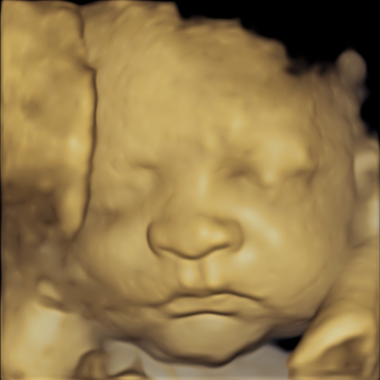 Detailed 3D ultrasound portrait of baby’s face