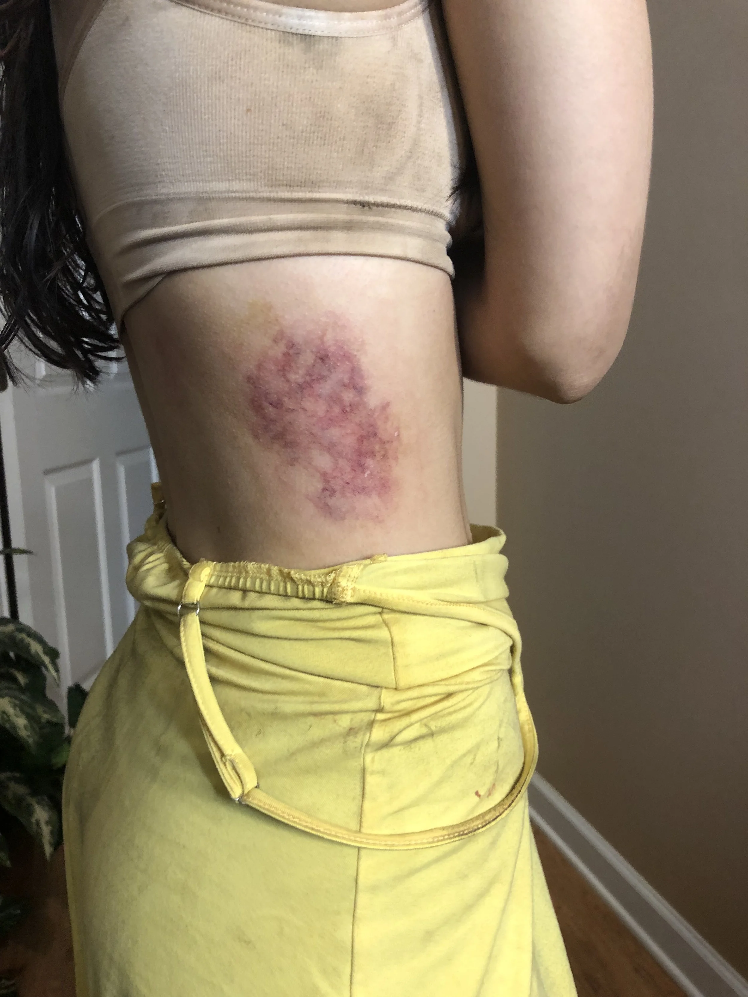 MUFX on Ryan Buffa short "Sweetheart", bruising on Cassady McClincy