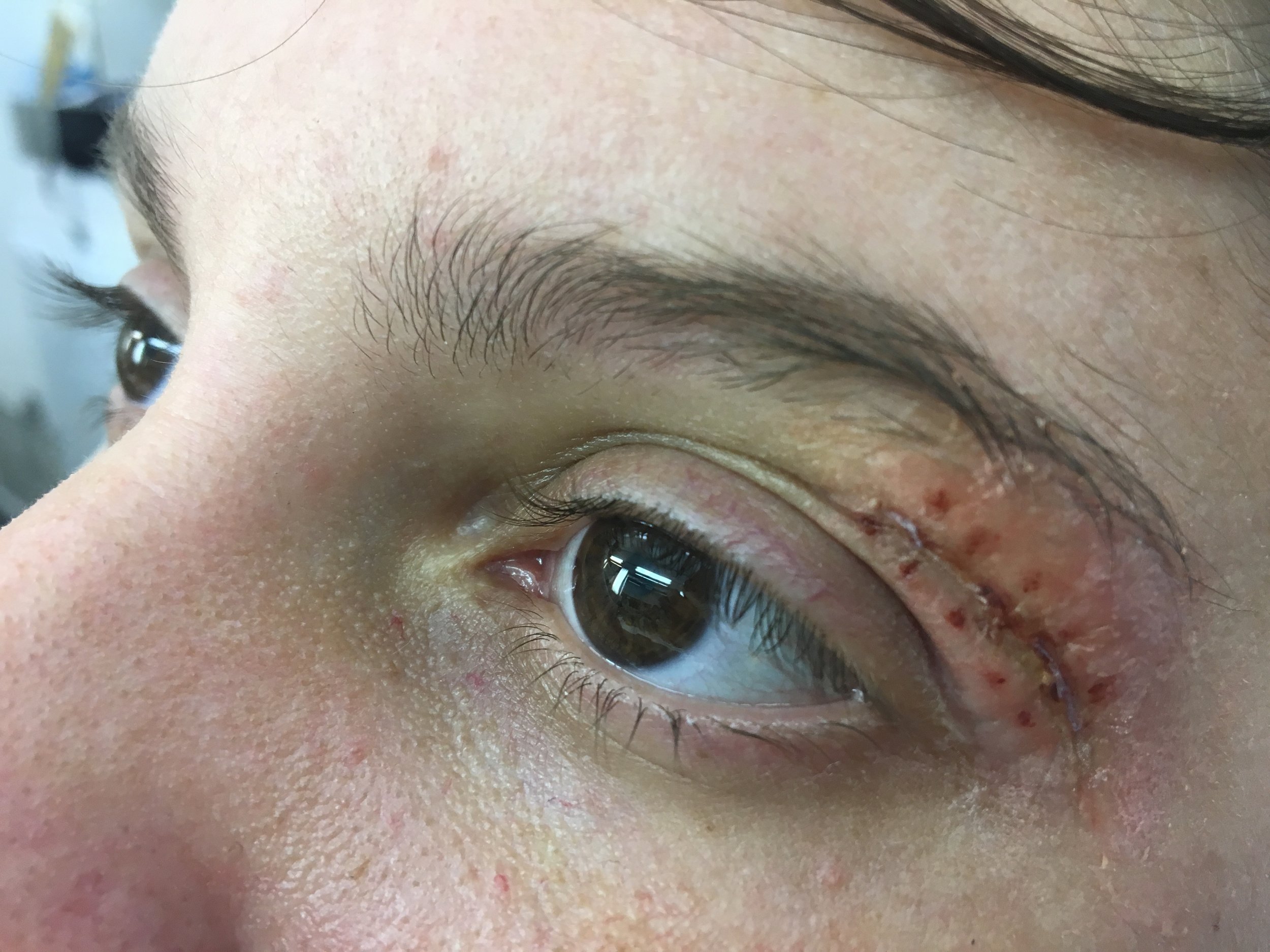 Eye wound test makeup