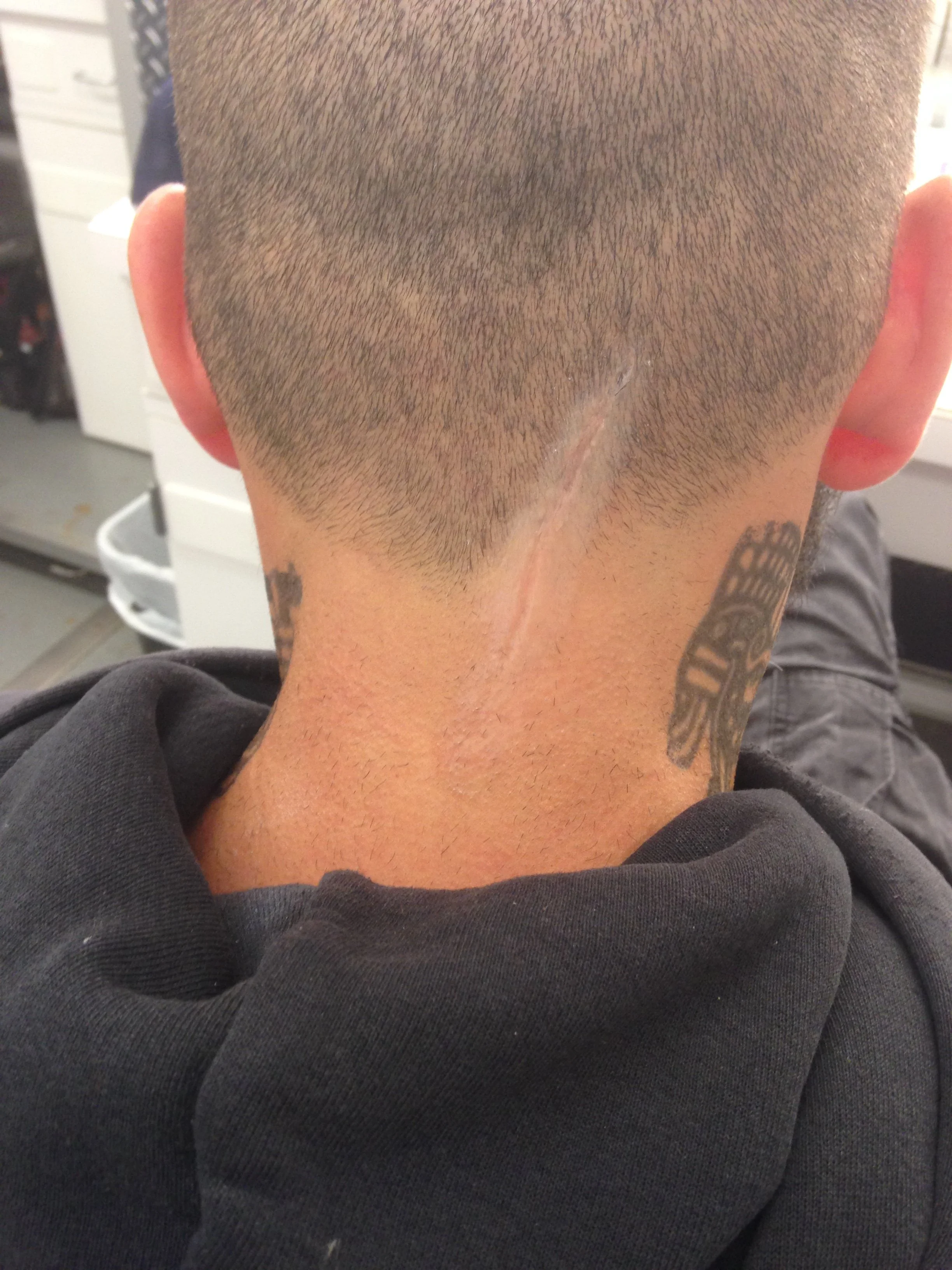 Baby Driver (scar on Jon Bernthal)