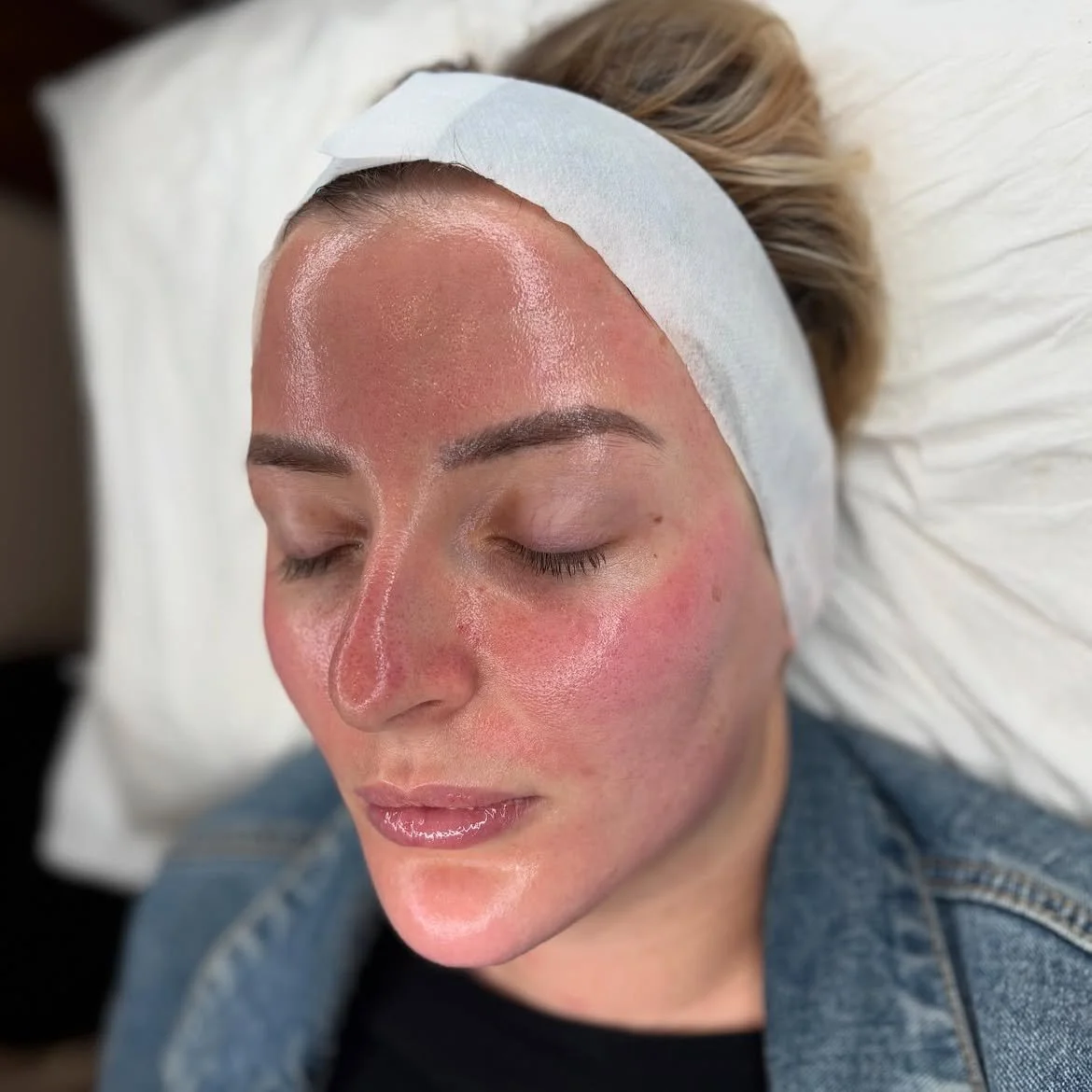 Professional facial treatment results at Laser & Skin Studio Kent