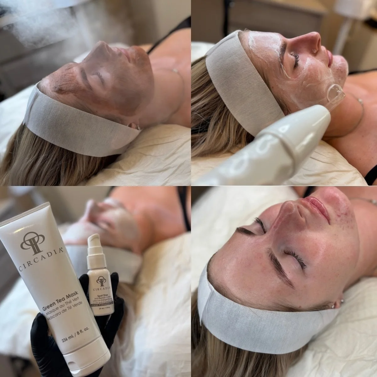 ✨ FIRST TREATMENT | HEALING THE SKIN BARRIER ✨

This lovely client came to me after experiencing persistent breakouts around her chin for the past couple of years, which began after coming off the contraceptive pill.

Rather than immediately targetin