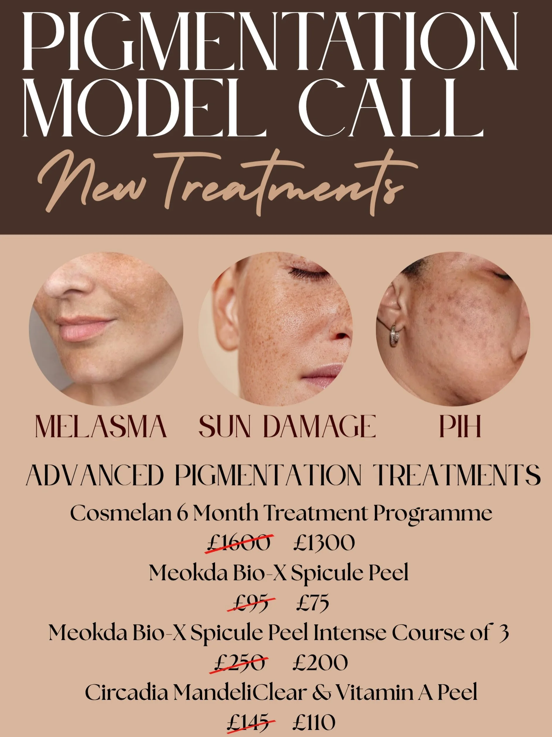 ✨ PIGMENTATION MODEL CALL &ndash; NEW TREATMENTS ✨

Are you struggling with pigmentation and looking to achieve a clearer, more even-looking complexion? 🤎

We&rsquo;re looking for models to experience our new advanced pigmentation treatments at Lase