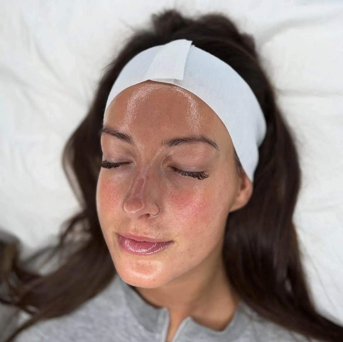 Client following a professional facial treatment at Laser & Skin Studio Kent