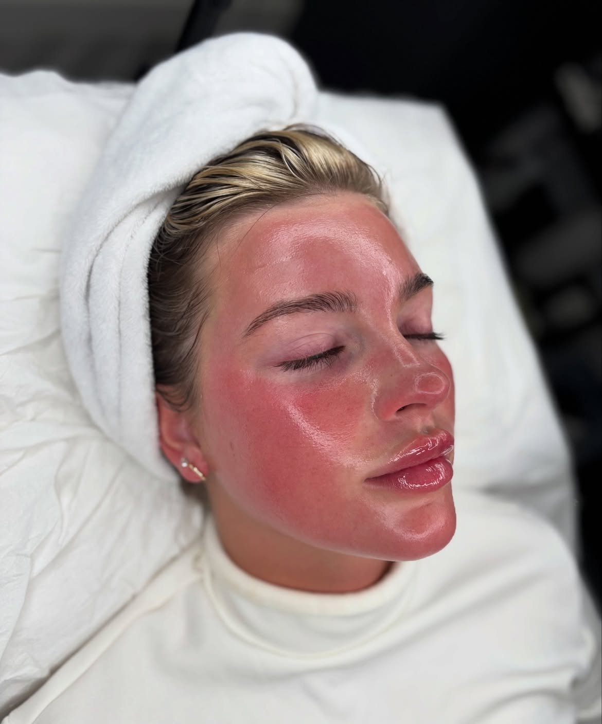Client during a professional skin treatment at Laser & Skin Studio Kent
