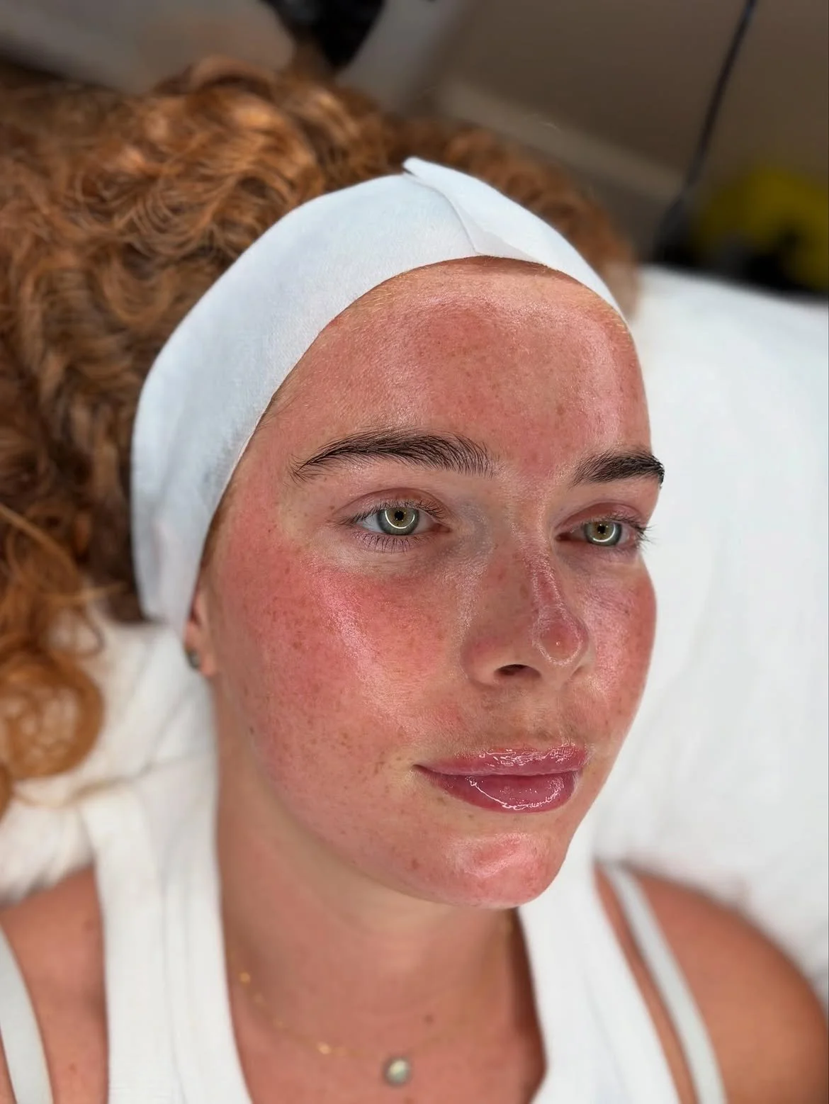 Client after a bespoke skin treatment at Laser & Skin Studio Kent