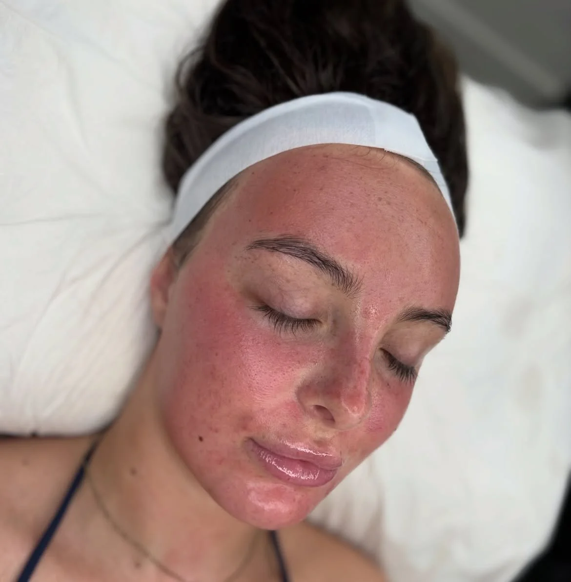 Client receiving an advanced facial treatment at Laser & Skin Studio Kent