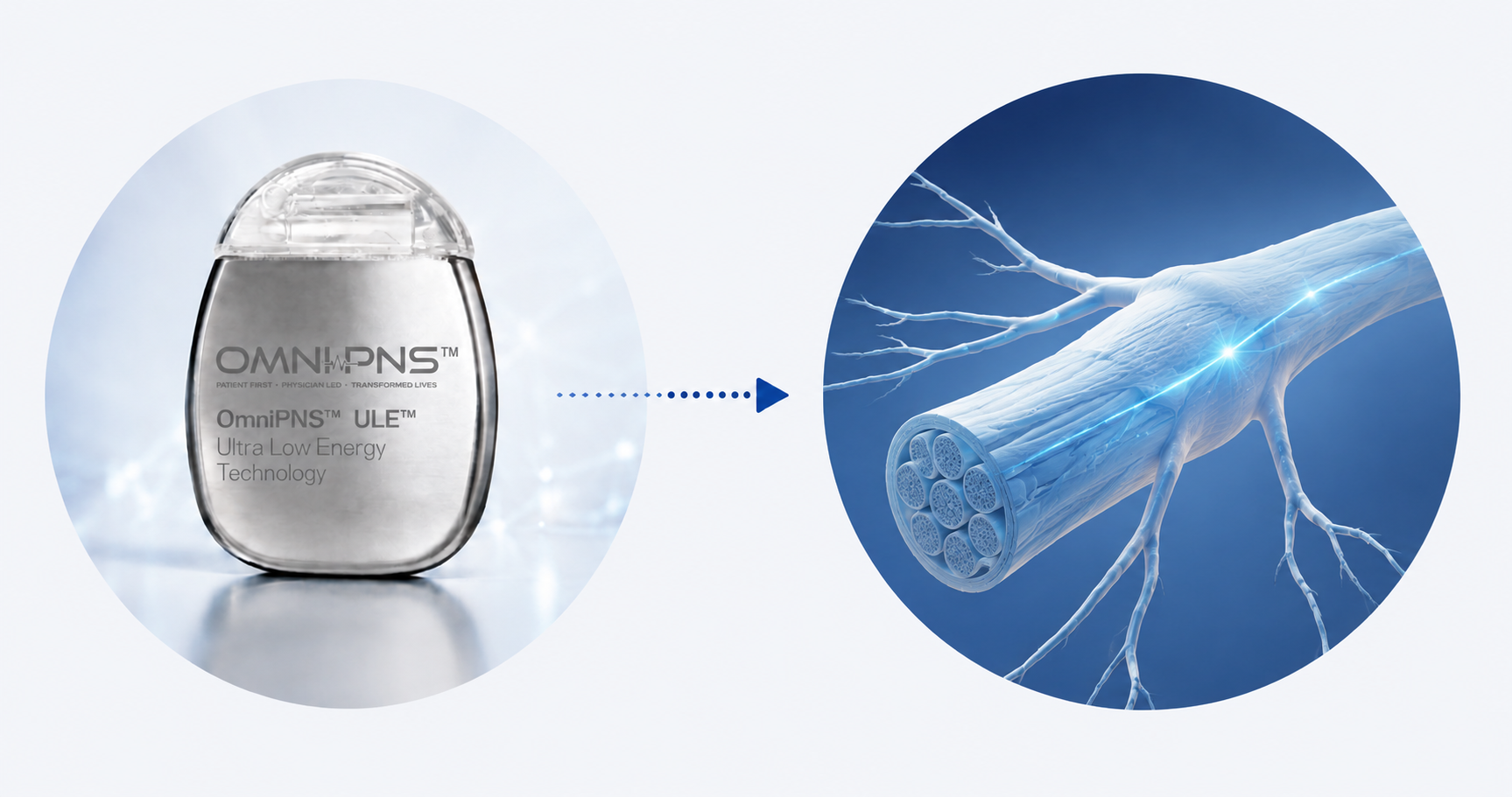 OmniPNS device and nerve