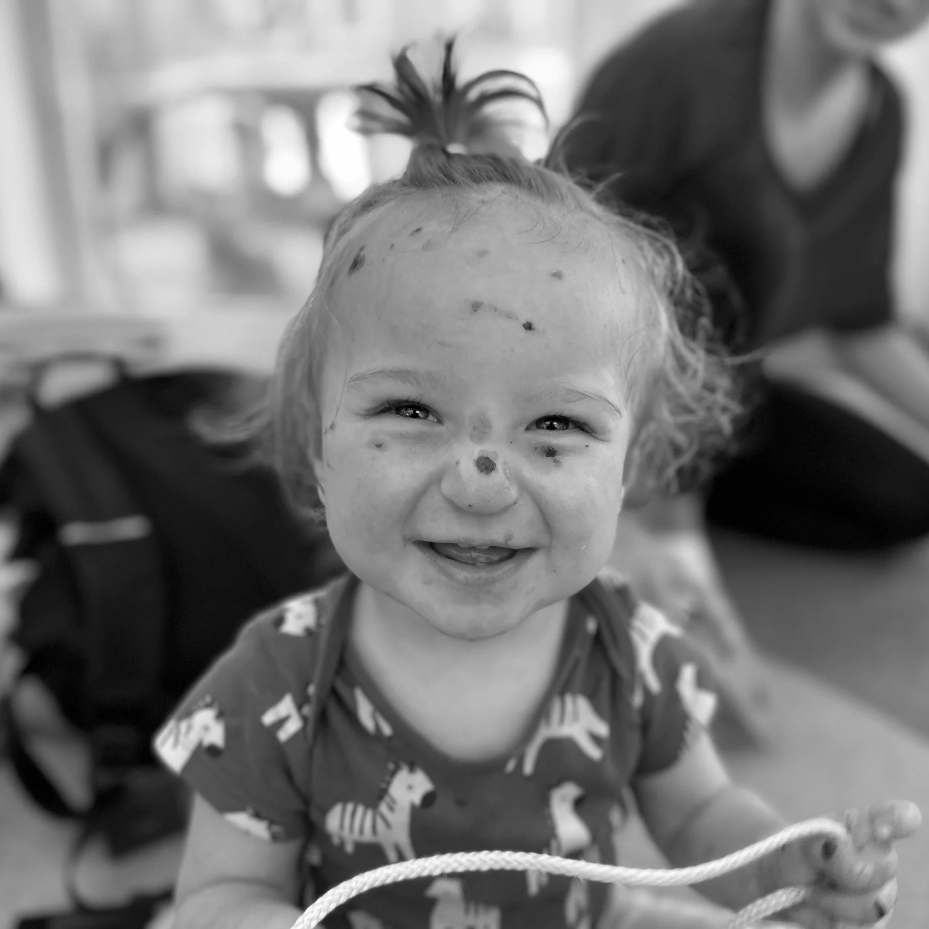 Photo of Child with EB Austria