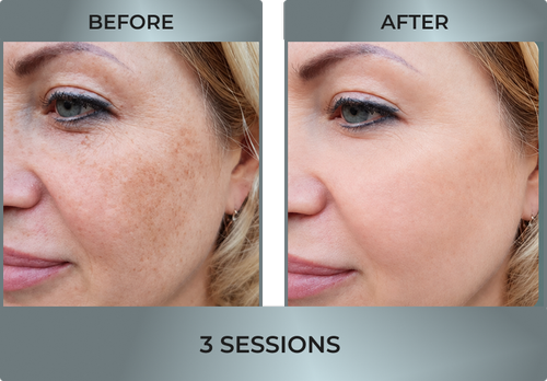 Facial 2.webp
