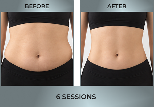 Cry-Slimming