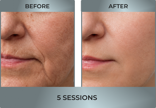 facial1.webp