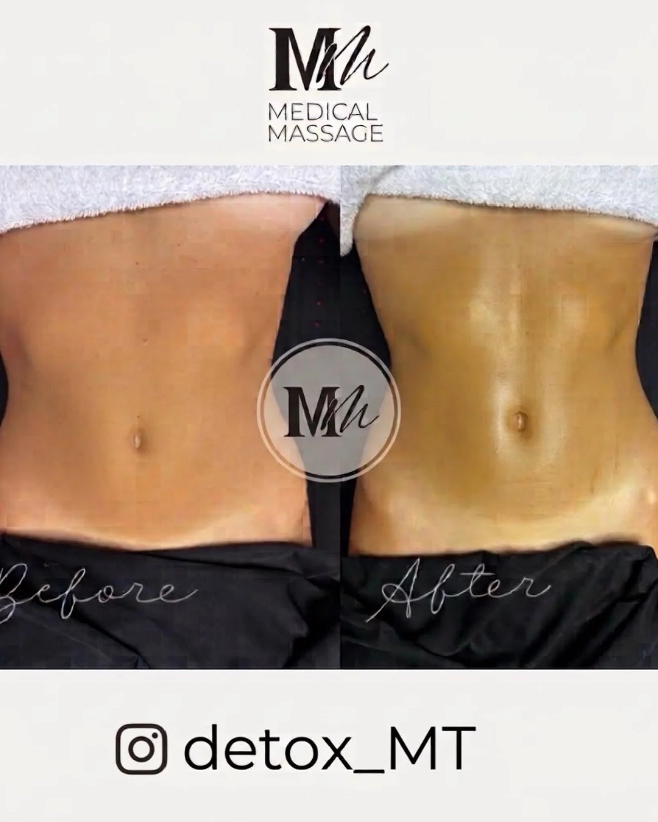 Book your lymphatic with me at www.lymphaticdrainagemassagespecialist.com