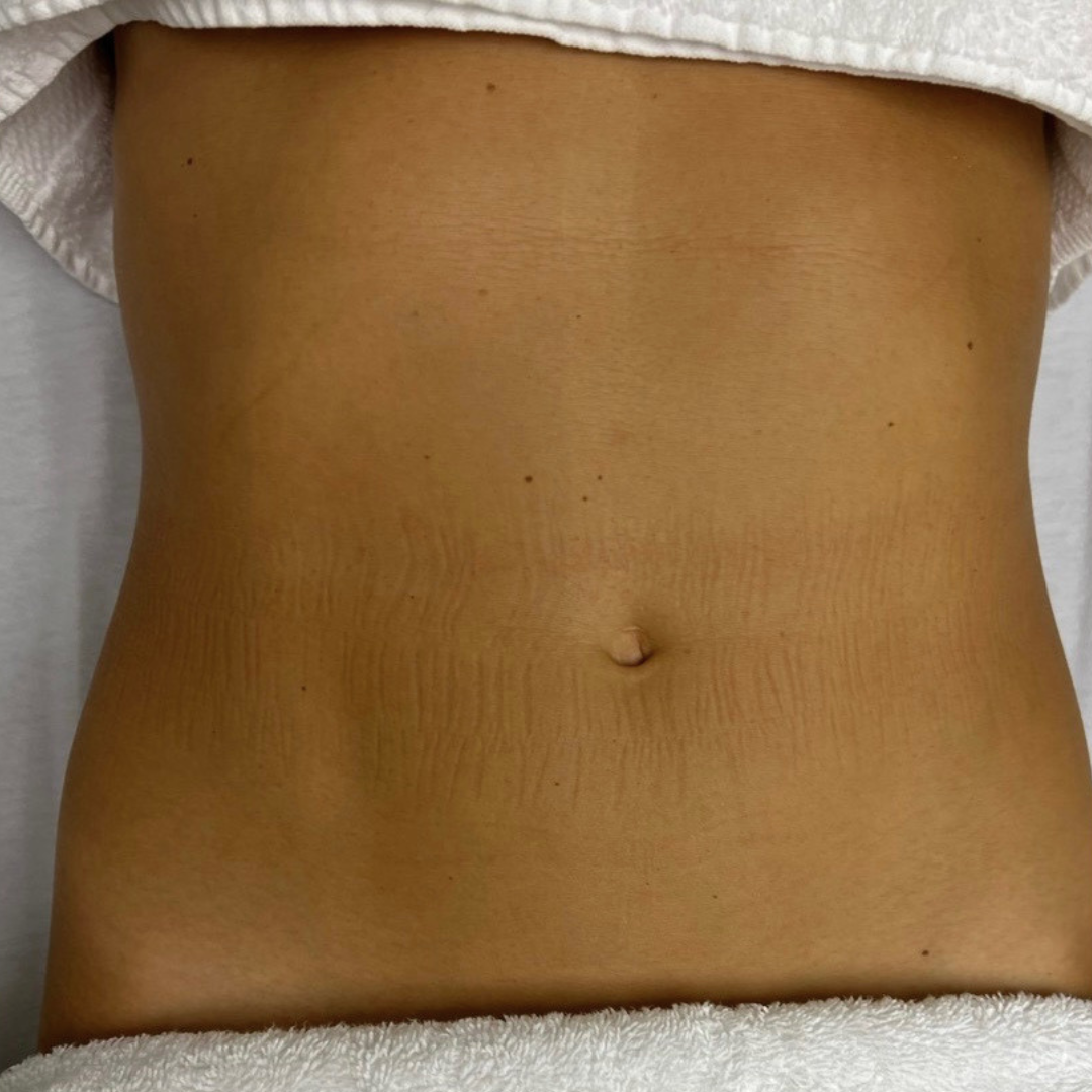 Close-up of a person's bare abdomen with visible skin texture and a belly button.