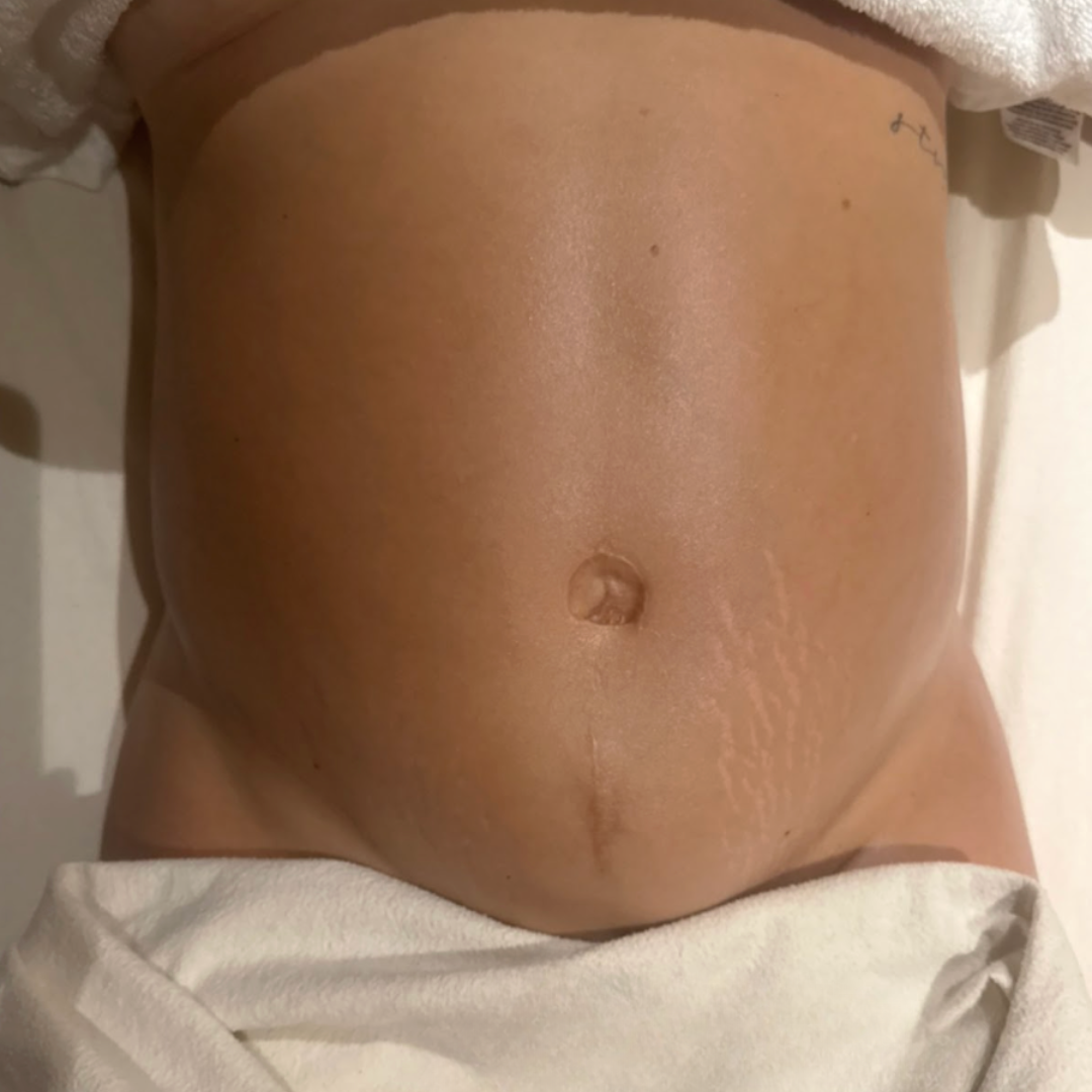 Close-up of a person's bare abdomen showing skin texture and a small tattoo near the right side.