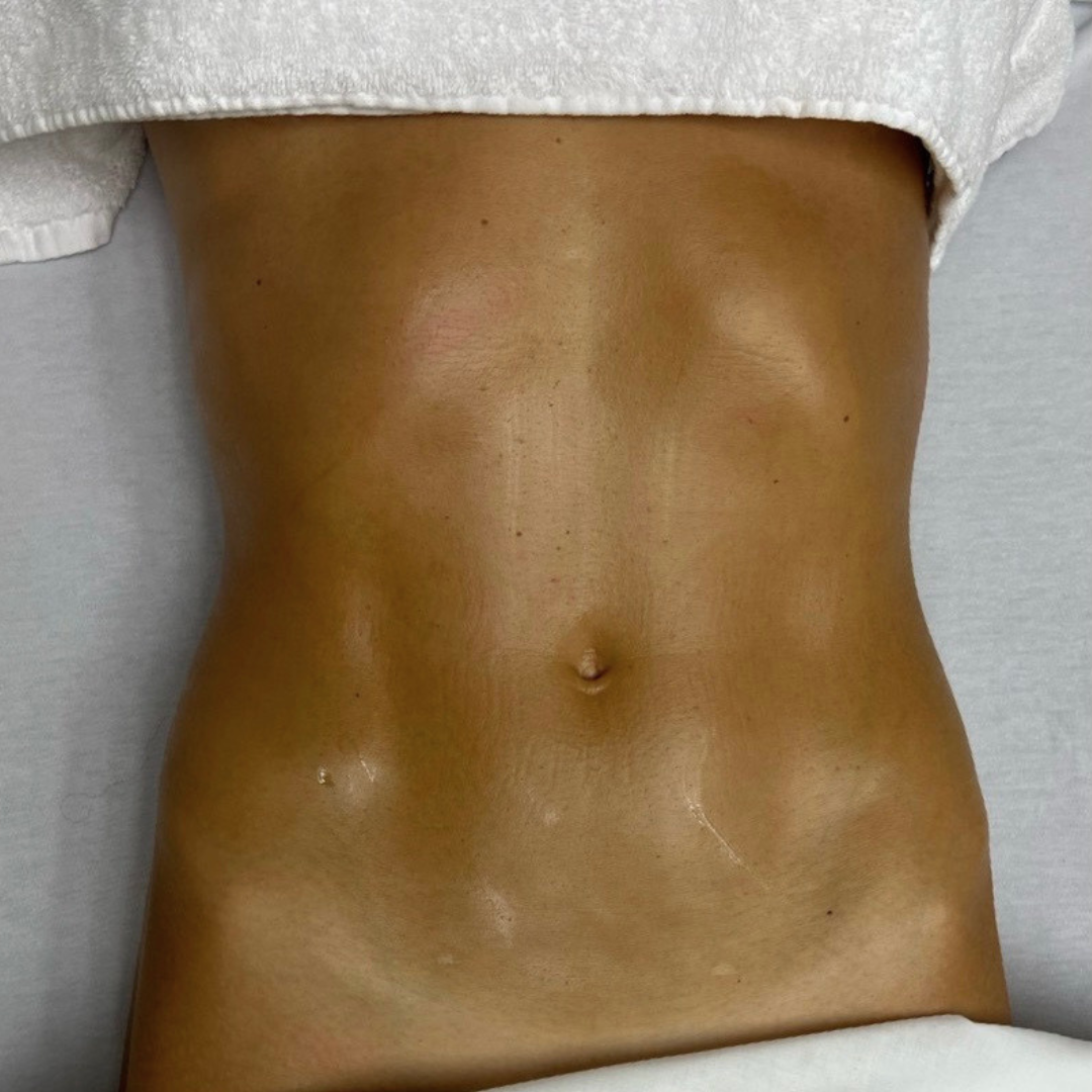 Close-up of a person's bare abdomen and waist, showing skin details and an innie navel, with part of a white towel or garment at the top.