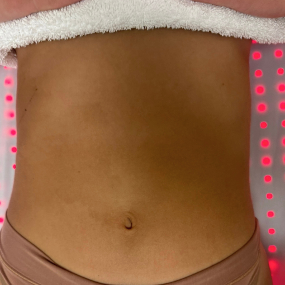 Close-up of bare midsection with belly button, wearing beige pants and a white towel on top, with red LED lights in background.