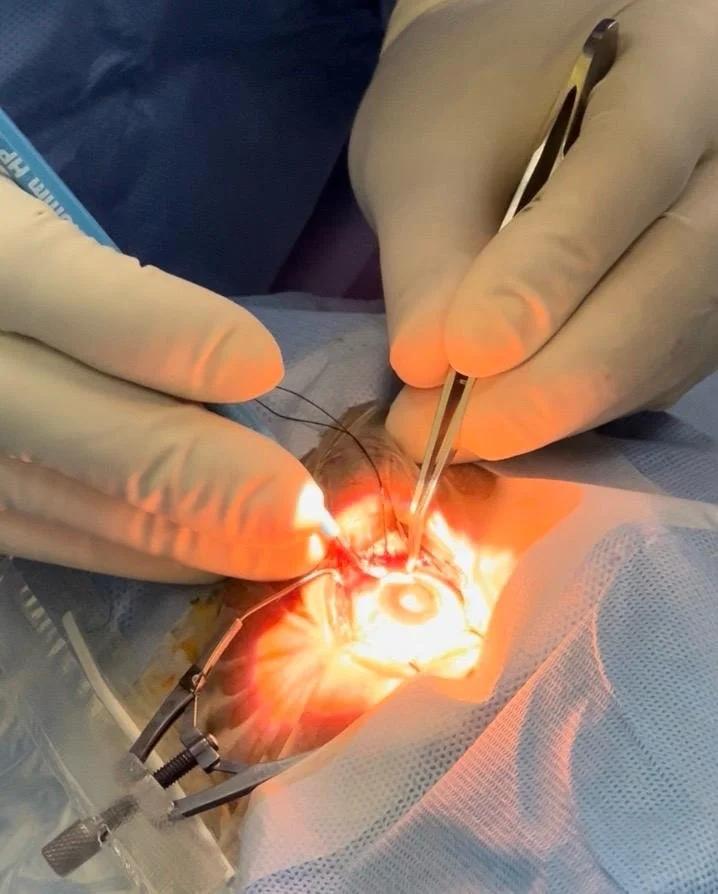 MBSHM medical mission-cataract surgery.jpg
