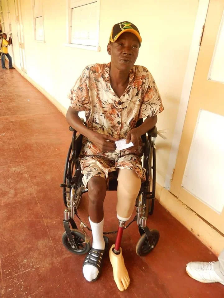 MBSHM mission trip 2019-prosthesis 2.jpg