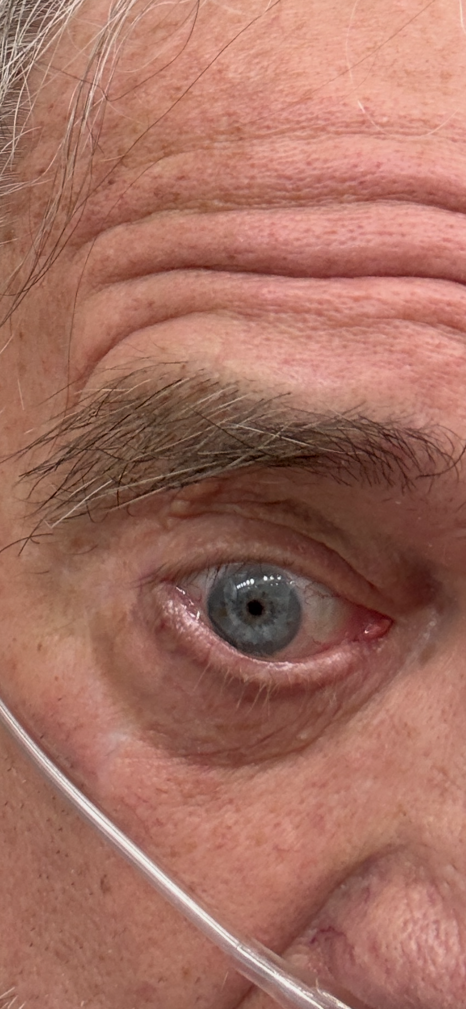 Close-up of a person's face, showing one open eye with blue iris, a grey eyebrow, and part of the forehead with wrinkles. The person has a light skin tone, and part of the nose and cheek are also visible.