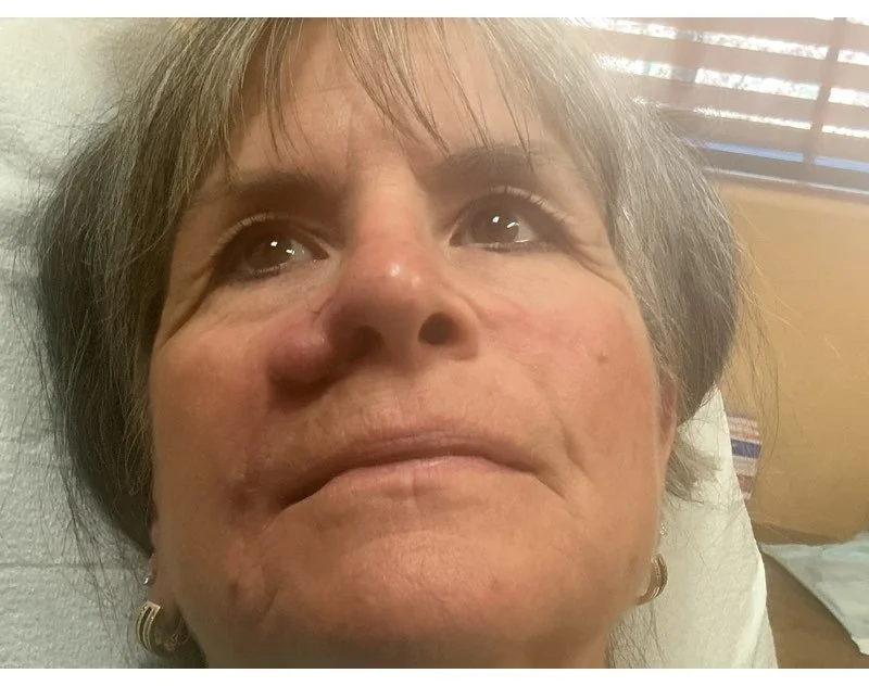 Close-up of a woman lying in a hospital bed, looking upward, with hospital window blinds in the background.