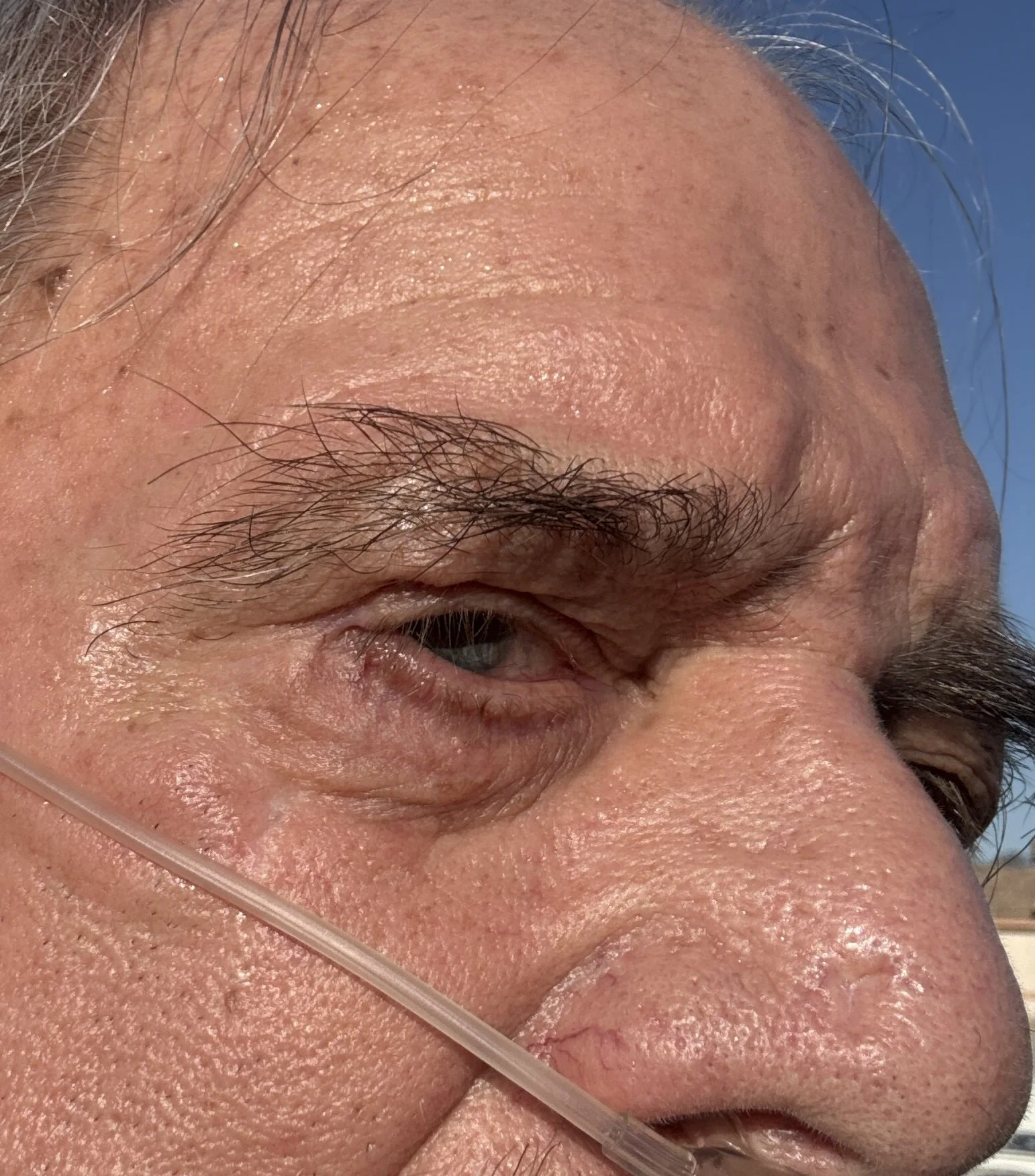 Close-up of an elderly man's forehead, eye, and nose, showing signs of aging skin, wrinkles, and sparse facial hair.