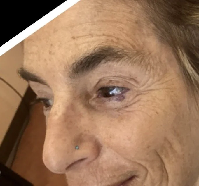 Close-up of an elderly woman's face showing wrinkles around her eye and cheek, with a small blue nose piercing.