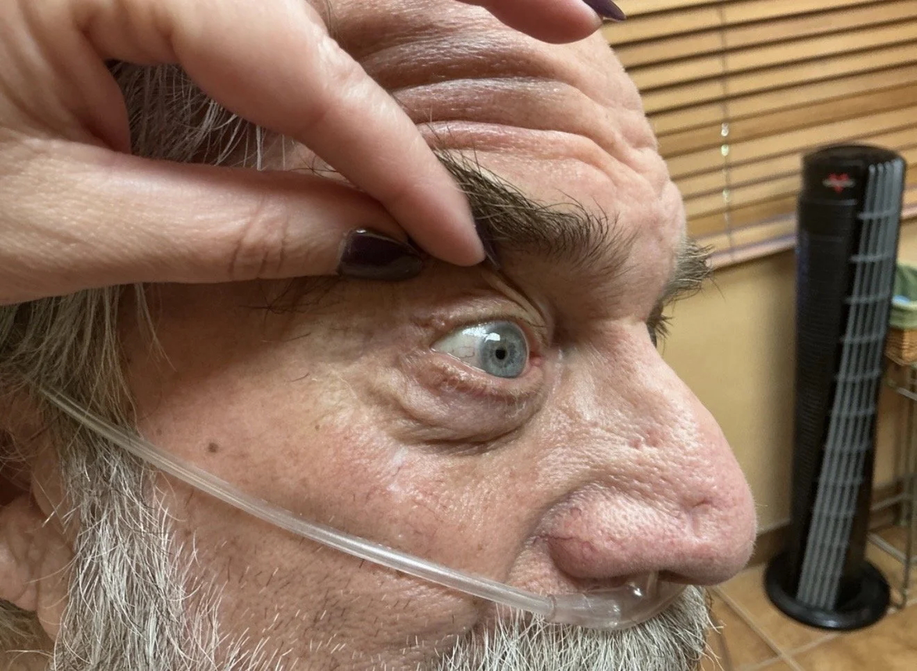 Close-up of a senior man's face, showing his eye, forehead, and nose, with a hand touching his forehead. He has a beard and is wearing oxygen tubing. Background includes a wooden window blind and a black tower fan.